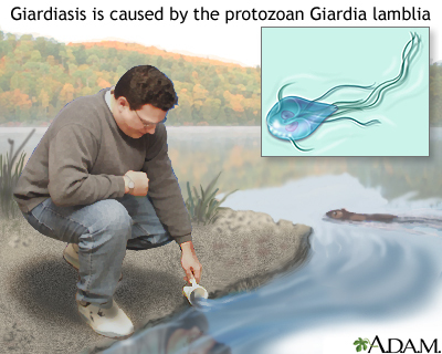giardiasis in well water