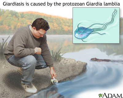 giardia in lake water)